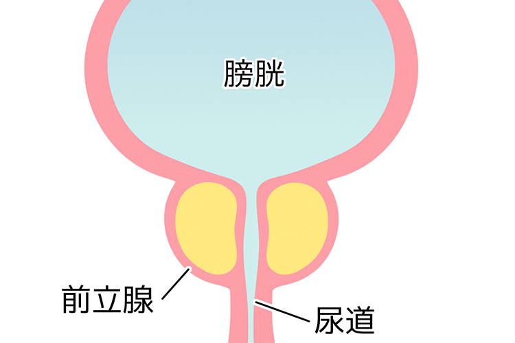 前立腺肥大症のイメージ写真